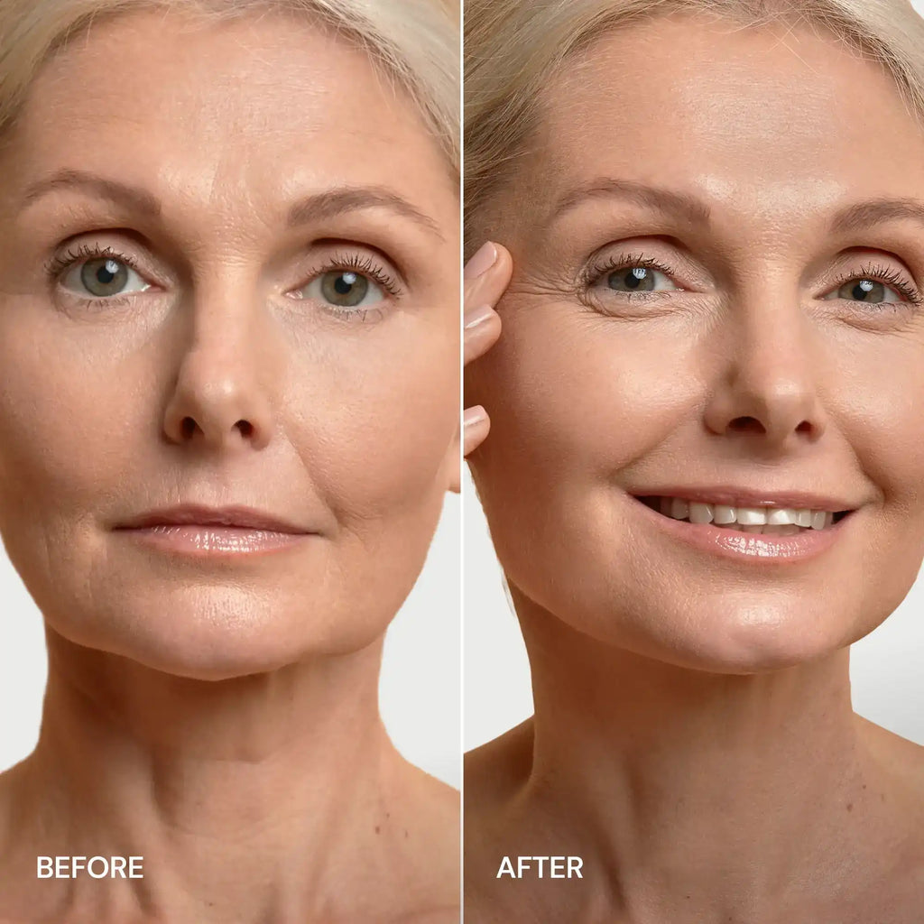 24K Gold V-Line Lifting Mask